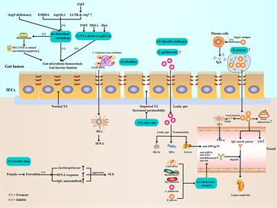 Gut Microbiota Dysbiosis in Systemic Lupus Erythematosus: Novel Insights into Mechanisms and Promising Therapeutic Strategies